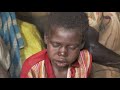 Neglected Diseases - Nodding disease