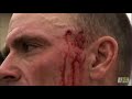 A Gator Bite to the Head is No Joke | Gator Boys