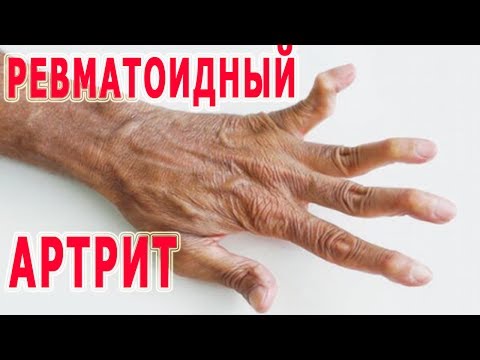 Сколиоз Сделать УЗИ в Москве - цены, отзывы, гарантия качества