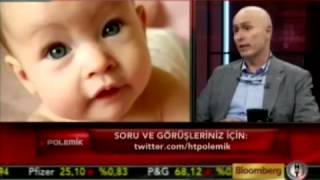 Kurtaj Ve Sezaryen Polemigi Prof Dr Bulent Urman Youtube