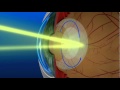 Posterior Capsulotomy Video