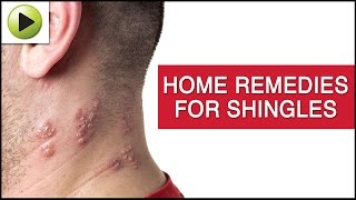 Skin Care Shingles Natural Ayurvedic Home Remedies Youtube