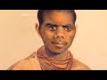 What Scientific Racism Did to The Blacks World Wide.