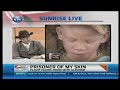 Sunrise Live Interview - Prisoner of my skin