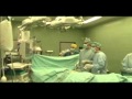 "שקט מנתחים" - כריתת תוספתן (אפנדיקס) appendicitis
