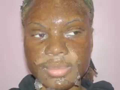Beauty 7-Day Chemical Peel tca chemical peel. Beauty 7-Day Chemical Peel