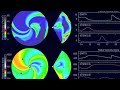 4MIN News May 18, 2013: Magnetic Storm