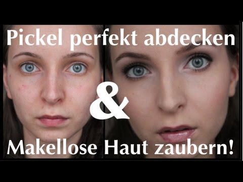 pickel im gesicht nach epilieren