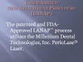 LANAP Laser Gum Surgery Alternative | Periodontist Philadelphia Implant Dentist