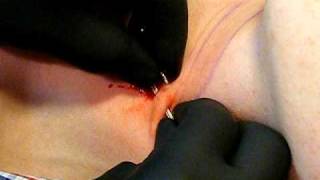 Throat Surface Piercing