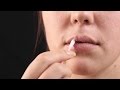 Treatment for cold sores (fever blisters)