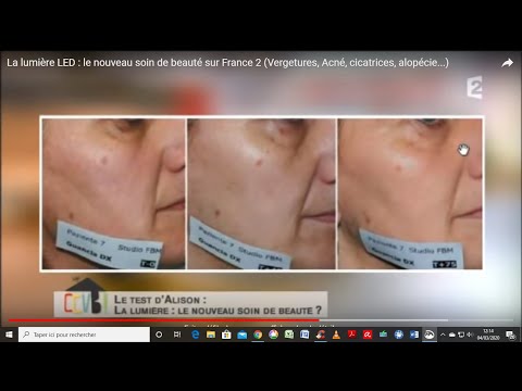 Lhuile cosmétique de cèdre pour la personne