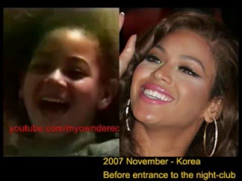 beyonce plastic surgery