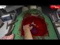 Vidéo choc: Un chirurgien rate une transplantation cardiaque! - Surgeon Simulator 2013