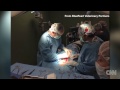 Doctors remove a four-pound what?!