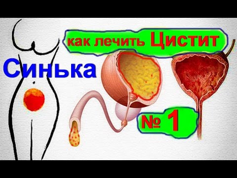 Мочевой пузырь лечение в домашних условиях Мочевой пузырь лечение в домашних условиях