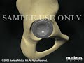 Hip Surgery