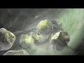 3D Medical Animation: Gallbladder Removal Surgery due to Gallstones