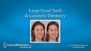 cosmetic teeth large