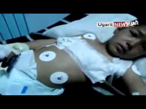 طفل سوري يروي قصة تعذيبه 