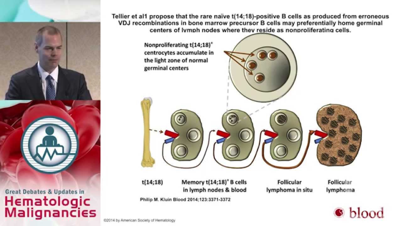 Debate A Case of Stage IV Follicular Lymphoma RCHOP or BR