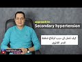 Approach to secondary hypertension  ??? ??? ??? ??? ?????? ????? ???????[1]