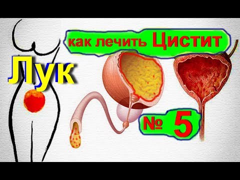 Как вылечит цистит при домашних условиях Как вылечит цистит при домашних условиях