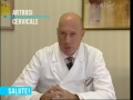 Artrosi cervicale Artrosi cervicale