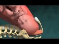 3D Medizinische Animation: Normal Vaginal Geburt mit der Halswirbelsäule Auslöschung und Erweiterung (Dilatation)