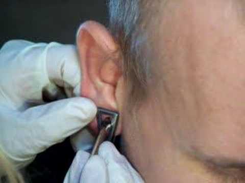 My girlfriend piercing Levi's ear with a 4g needle. My girlfriend piercing Levi's ear with a 4g needle.