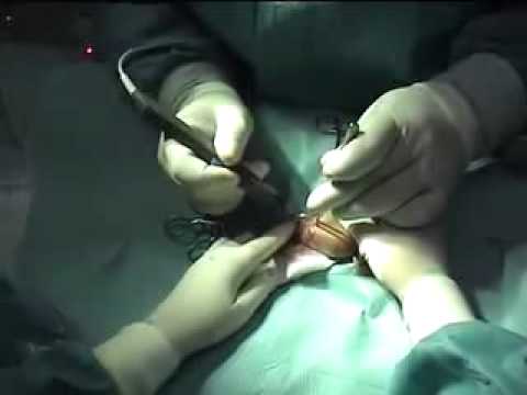Circumsision.divx - VidoEmo - Emotional Video Unity