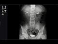 paediatric gentourinary cases 1 (part 1)