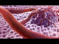 3D Medical Animation - What is Cancer?
