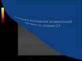 Нажмите для просмотра : Аномалия вхождения позвоночной артерии на уровне С4