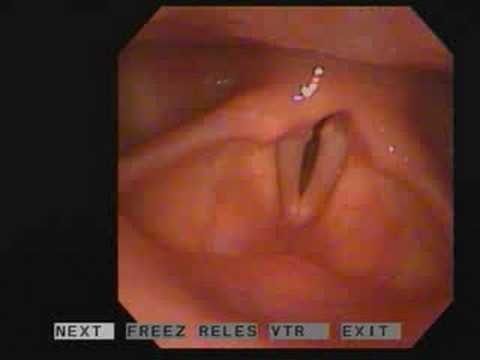 Vocal Strings