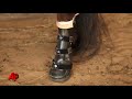 Mini Horse Gets Lifesaving Prosthetic Leg