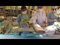 AWAKE BRAIN SURGERY (Uncensored) - Resection of Oligodendroglioma, Right Frontal Lobe