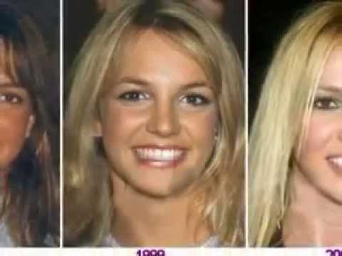 megan fox before and after surgery pictures 2010. megan fox before and after
