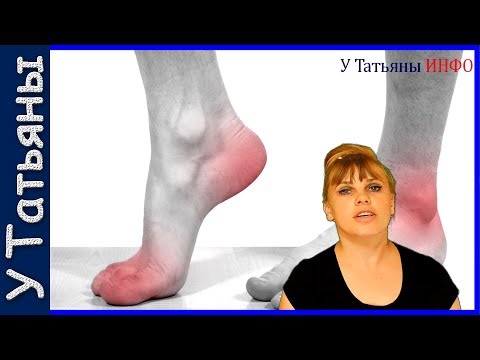 Болят колени как похудеть Болят колени как похудеть