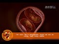 INVITRO - künstliche Befruchtung - Kinderwunsch