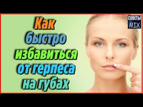 Герпес лечить в домашних условиях Герпес лечить в домашних условиях