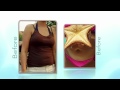 Video: Sono Bello Body Contouring Testimonial -- Shari, 37
