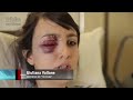 Reporter tells how the Police brutality marked the latest protest