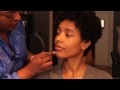 Reasons for Skin Discoloration : Skin Care Advice