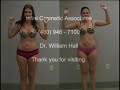 Liposuction / Lipo Procedure with Dr. William Hall - Kelli Documentary