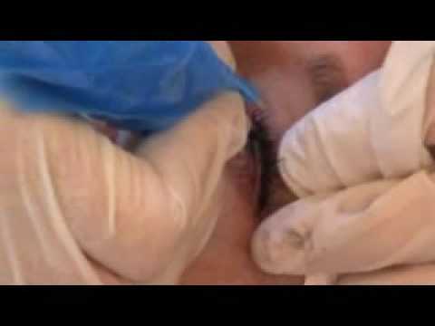 Permanent Makeup Procedure: Application of Eyeliner Tattoo and Eyelash 