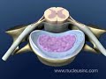 3D Medical Animation:  Cervical Spine & Disc Anatomy