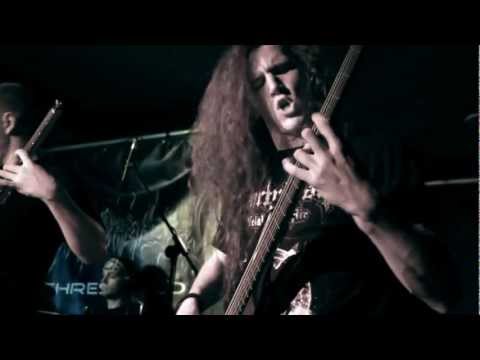 Over Your Threshold "Cortical Blindness" Live
