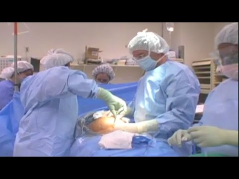 C-Section Surgery | BabyCenter Video 5:44