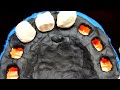 Cookie Monster Gets Teeth by Play Doh Doctor Drill N Fill Playset Sesame Street Elmo Dentist!